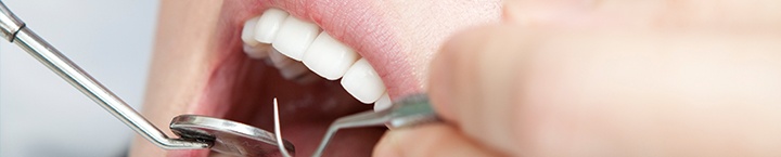 구강 검사와 치석 제거를 설명하는 사진